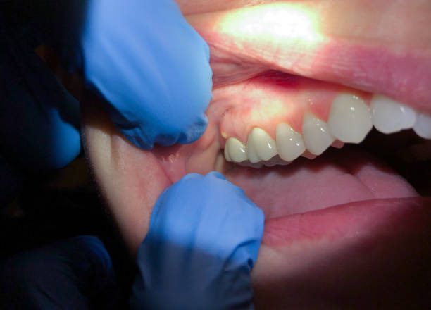 Best Emergency Orthodontic Repairs in Ashland, CA