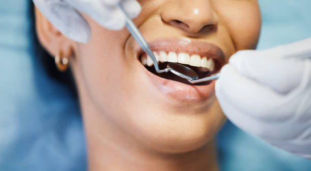 Best 24-Hour Emergency Dentist in Ashland, CA